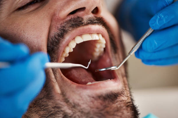 Best Emergency Cosmetic Dentistry in College Park, MD