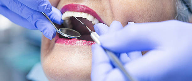 Best Emergency Cosmetic Dentistry in College Park, MD